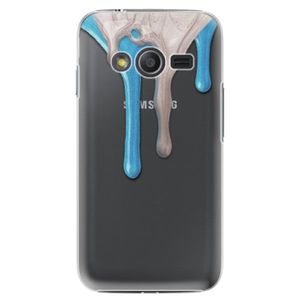 Plastové puzdro iSaprio - Varnish 01 - Samsung Galaxy Trend 2 Lite vyobraziť