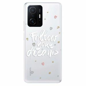 Odolné silikónové puzdro iSaprio - Follow Your Dreams - white - Xiaomi 11T / 11T Pro vyobraziť